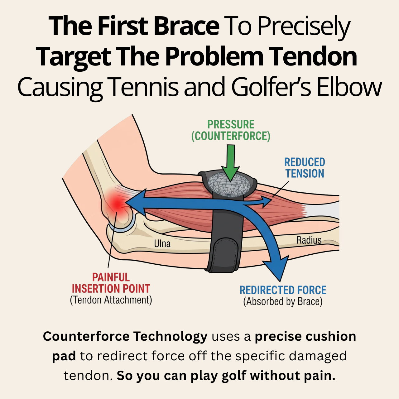 Control Point Pro™ Elite Counterforce Brace