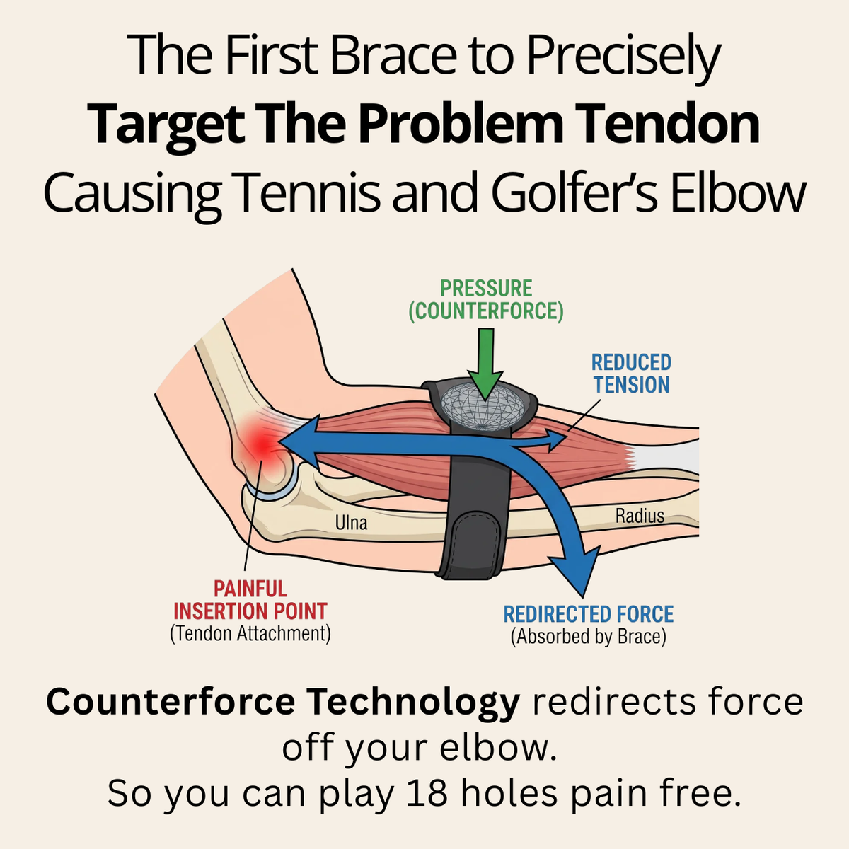 Control Point Pro™ Counterforce Brace